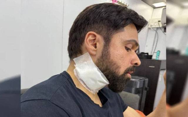 Star Actor Imran Hashmi injured, city42 , Gada Chari Part 2 